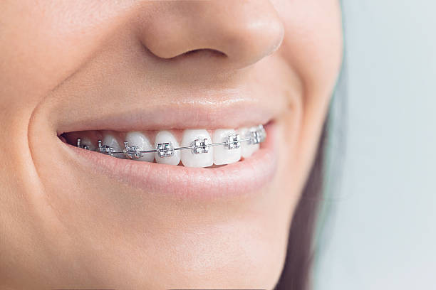 Best TMJ/TMD Treatment  in Mpbell, CA